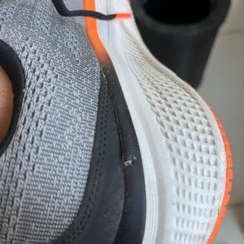 Skechers Ayakkabıda Deformasyon Ve Yetersiz Müşteri Desteği Mağduriyeti