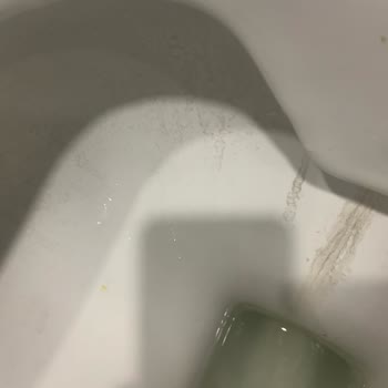 Kale Leke Tutmaz Denilen Klozetin Taşında Kalıcı Siyah Lekeler Oluşuyor