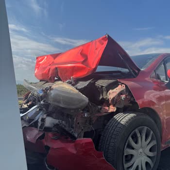 Airbag Sorunu Ve Servis İlgisizliği: Mağduriyetim Giderilmiyor