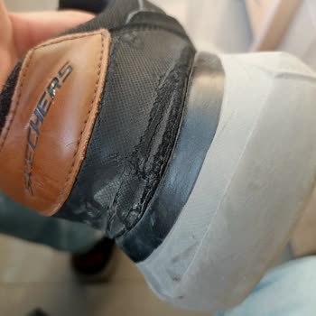 Skechers Ayakkabıda Bir Yıl Dolmadan Yırtılma Ve Garanti Reddi Mağduriyeti