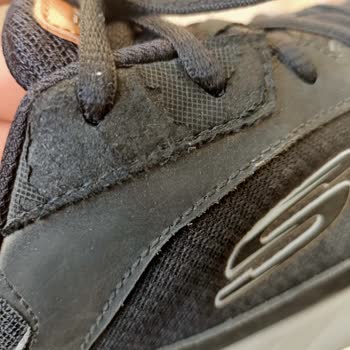 Skechers Ayakkabıda Bir Yıl Dolmadan Yırtılma Ve Garanti Reddi Mağduriyeti