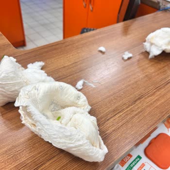 Bebek Bezinde Küf Ve Parçacık Sorunu: Bebeğimin Sağlığı Tehlikeye Girdi