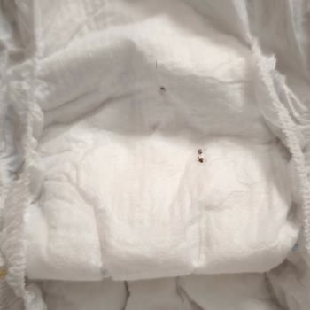 Bebek Bezinde Böcek Kalıntısı Ve Yanıt Alamama Mağduriyeti