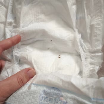 Bebek Bezinde Böcek Kalıntısı Ve Yanıt Alamama Mağduriyeti