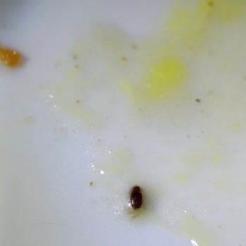 Paket Serviste Çorbanın İçinden Hamamböceği Çıkması Ve Yetersiz Geri Dönüş