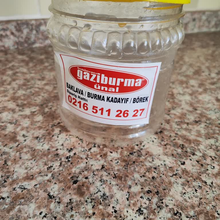 Aldığım Zeytinden Saç Çıktı, Hijyen Ve İlgi Eksikliği Yaşadım