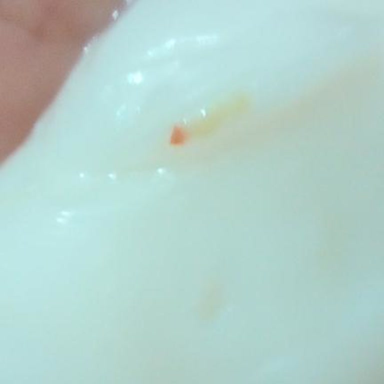 Satın Alınan Saç Maskesinden Kurt Çıkması Nedeniyle Hijyen Sorunu