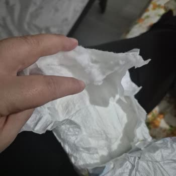 Molfix Bebek Bezinde Pamukların Dışarı Çıkması Hijyen Sorununa Yol Açıyor