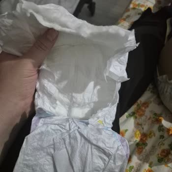 Molfix Bebek Bezinde Pamukların Dışarı Çıkması Hijyen Sorununa Yol Açıyor