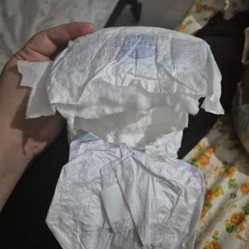 Molfix Bebek Bezinde Pamukların Dışarı Çıkması Hijyen Sorununa Yol Açıyor