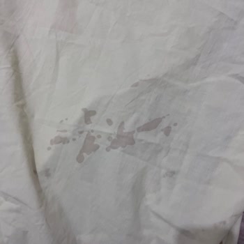 Altus Çamaşır Makinesi Kötü Koku Ve Yağ Lekesi Sorunu Çözümsüz Kaldı