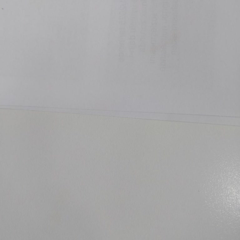 VakıfBank Sky Limitimin Düşürülmesine Anlam Veremiyorum, Muhatap Bulamıyorum