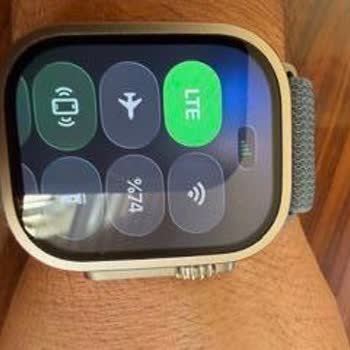 Apple Watch Ultra 3 İle Turkcell Hattında Arama Yapılamıyor, Yüksek Fatura Mağduriyeti