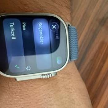 Apple Watch Ultra 3 İle Turkcell Hattında Arama Yapılamıyor, Yüksek Fatura Mağduriyeti