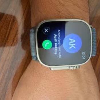 Apple Watch Ultra 3 İle Turkcell Hattında Arama Yapılamıyor, Yüksek Fatura Mağduriyeti