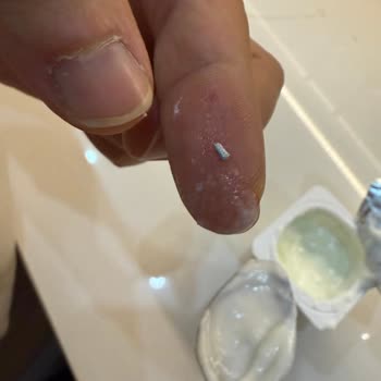 Aktivia Yoğurt İçinden Metal Parça Çıktı