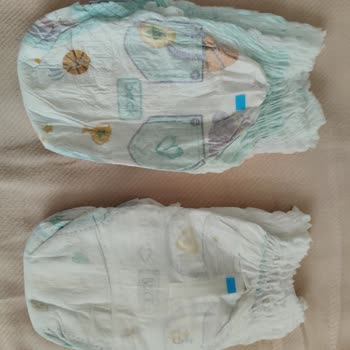 Prima Bebek Bezlerinde Islaklık Göstergesi Ve Dış Yüzey Değişikliği Endişesi