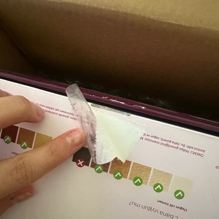 Kullanılmış Görünen Ürün Ve İade Sorunu: Mağduriyetimin Giderilmesini İstiyorum