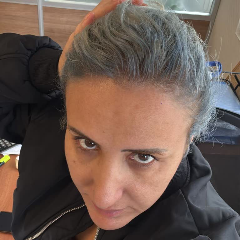 Saç Boyası Sarı Saçlarımı Beklenmedik Şekilde Maviye Çevirdi