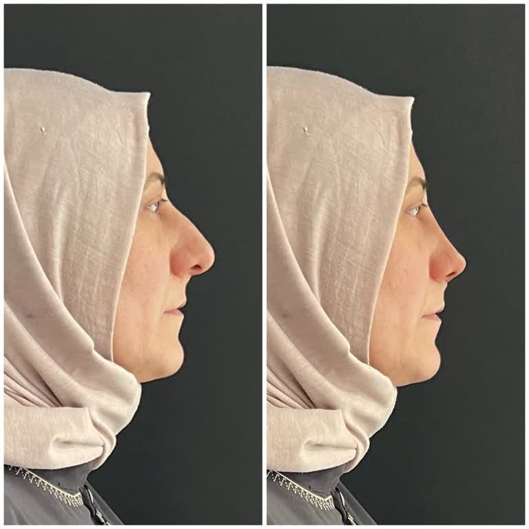 Aktif International Hospital Bana Gösterdikleri Resimle Yaptıklarının Hiç Alakası Yok