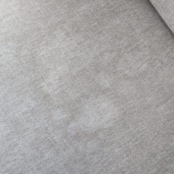 Kumaş Leke Sorunu Ve Garanti Kapsamında Çözüm Eksikliği