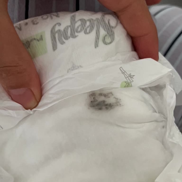 Bebek Bezinde Beklenmedik Yabancı Maddeyle Karşılaştım