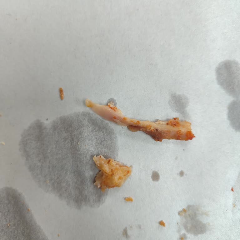 Dönerde Kıkırdak Ve Yetersiz Çalışan İlgisi: Hijyen Ve Hizmette İyileştirme Beklentisi