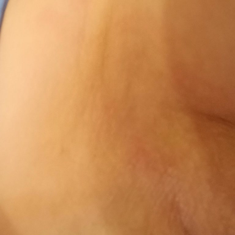 Yves Rocher Deodorant Ciddi Cilt Tahrişi Ve Sağlık Sorunu Yaşattı