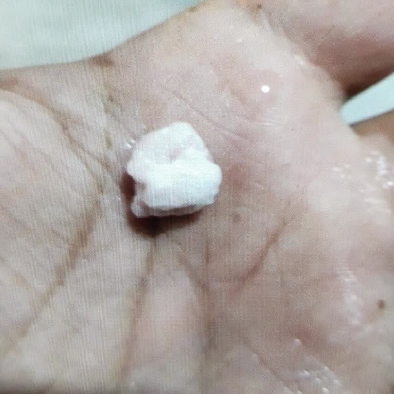 Aldığım Dana Kıyma Bozuk Çıktı, Sağlığım Tehlikeye Girdi Ve İade Talep Ediyorum