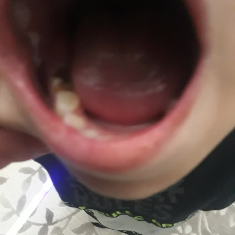 Çocuğumun Diş Tedavisinde Eksiklik Ve İlgisizlik Nedeniyle Mağduriyet Yaşıyoruz