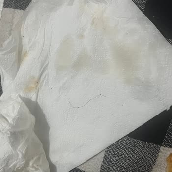 Siparişimde Yabancı Cisim Çıktı, Hijyen Kurallarına Uyulmuyor