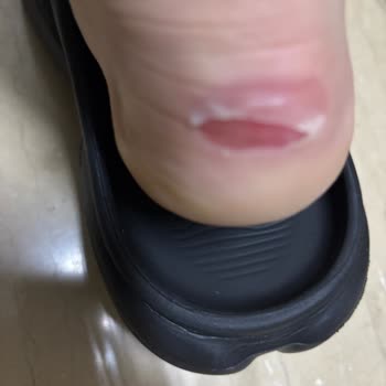 Kısa Sürede Ayağımı Yaralayan Ayakkabı Ve Çözüm Sunulmayan Mağduriyet