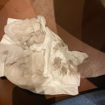 Starbucks Agua Florya Hijyen Eksikliği İçimizi Rahatsız Etti