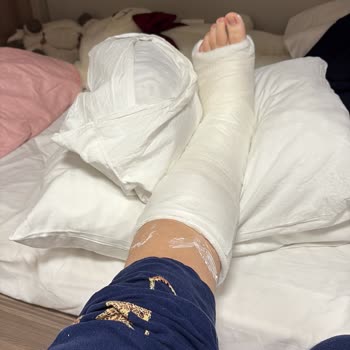 Yurt Yönetiminin İhmali Sonucu Yaralanma Ve Yetersiz Destek