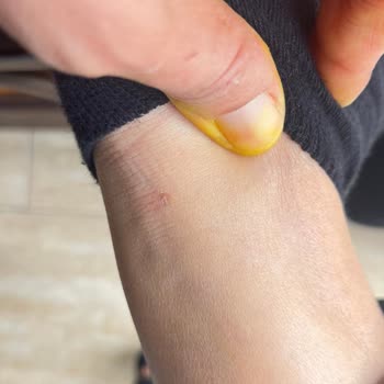 Toga Kar Botunda Yaşanan Rahatsızlık Ve İade Talebimin Reddi Nedeniyle Mağduriyet