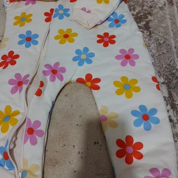 Hello Baby Bebeğimde Alerji Yapan Ürün