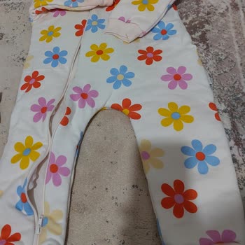 Hello Baby Bebeğimde Alerji Yapan Ürün