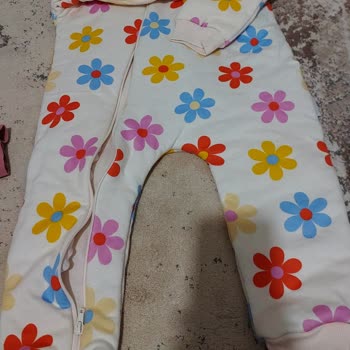 Hello Baby Bebeğimde Alerji Yapan Ürün