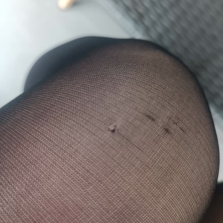 Aldığım Çorap Defolu Çıktı, Mağaza Ve Müşteri Hizmetleri Çözüm Sunmuyor