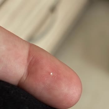 Kellogg’s Corn Flakes İçinden Cam Parçası Çıktı!