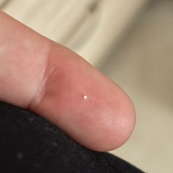 Kellogg’s Corn Flakes İçinden Cam Parçası Çıktı!