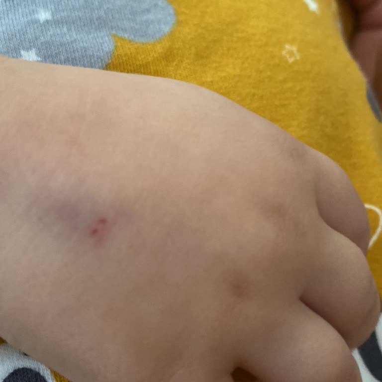 Acil Serviste Yetersiz Müdahale Ve İlgisizlik Nedeniyle Bebeğim Mağdur Oldu