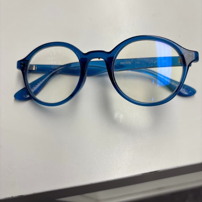 Gözlük Camlarının Yanlış Yerleştirilmesiyle Çocuğumun Sağlığı Riske Atıldı