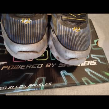 Kısa Sürede Hasar Gören Skechers Ayakkabı İçin İade Talebi Ve İnceleme Sonucuna İtiraz