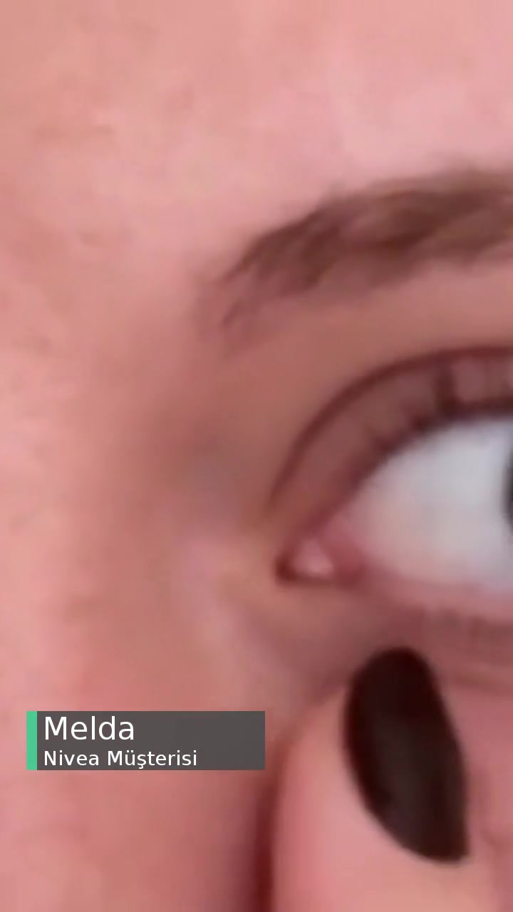 Nivea Göz Altlarımda Şişme, Kuruluk, Kızarıklık videonun kapak resmi
