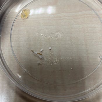 Ton Balığı Konservesinde Kılçık Ve Yabancı Cisim Şoku