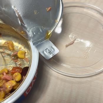 Ton Balığı Konservesinde Kılçık Ve Yabancı Cisim Şoku