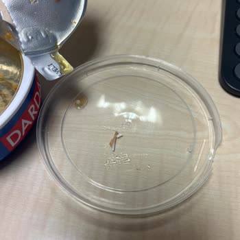 Ton Balığı Konservesinde Kılçık Ve Yabancı Cisim Şoku