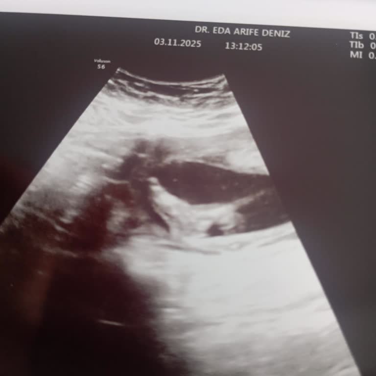 Hastanede Yetersiz Bilgilendirme Sonucu Bebeğimizi Kaybettik