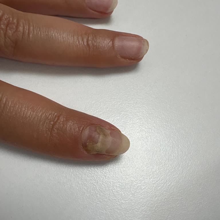 Malatya Liva Clinic Şikayeti